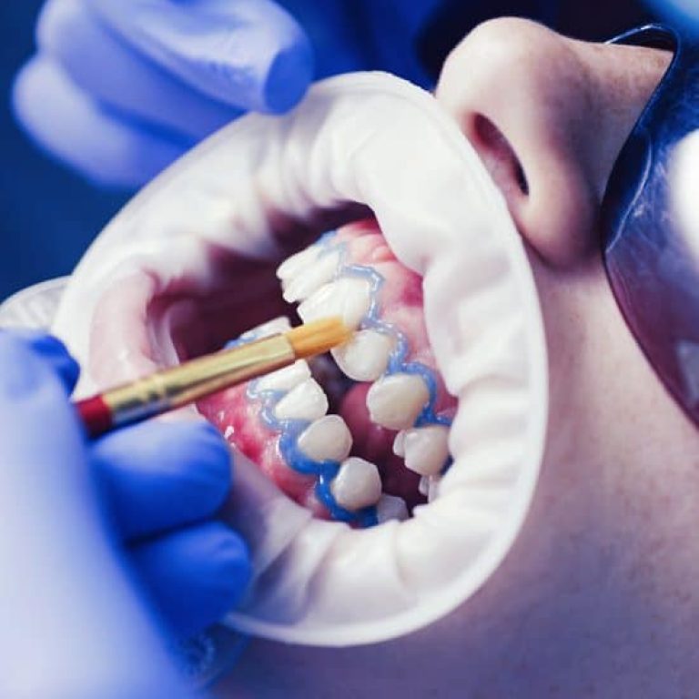 Close-up,Portrait,Of,A,Female,Patient,At,Dentist,In,The