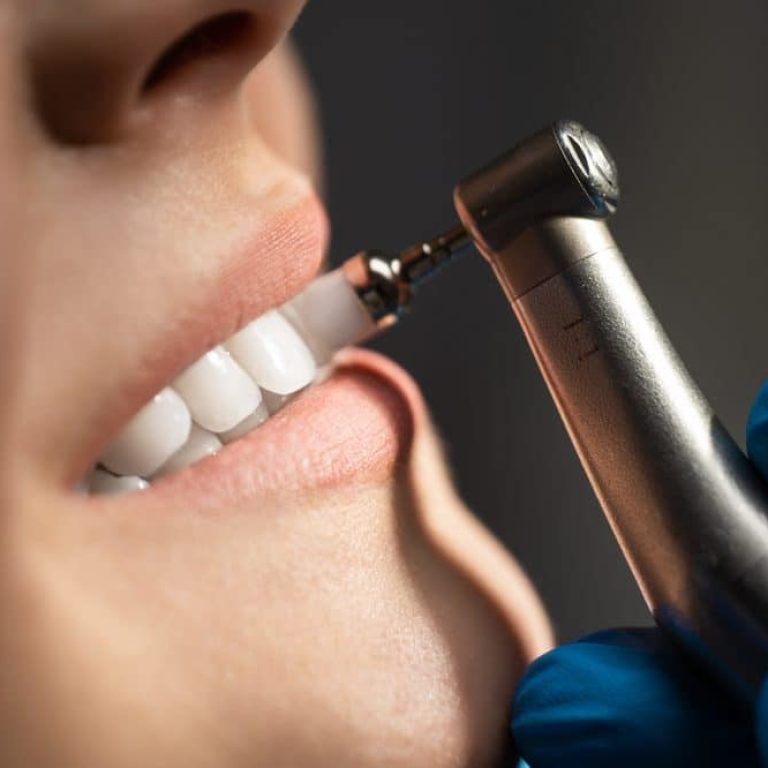 Process,Of,Using,Dental,Brush,As,A,Stage,Of,Professional