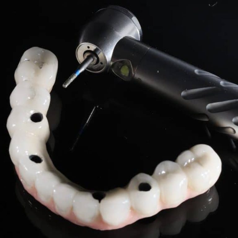 Full,Arch,Intraoral,All-on-four,,All-on-4,,And,All-on-x,Treatment,Prosthesis,For